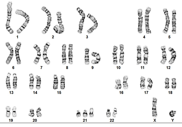 Human karyotype